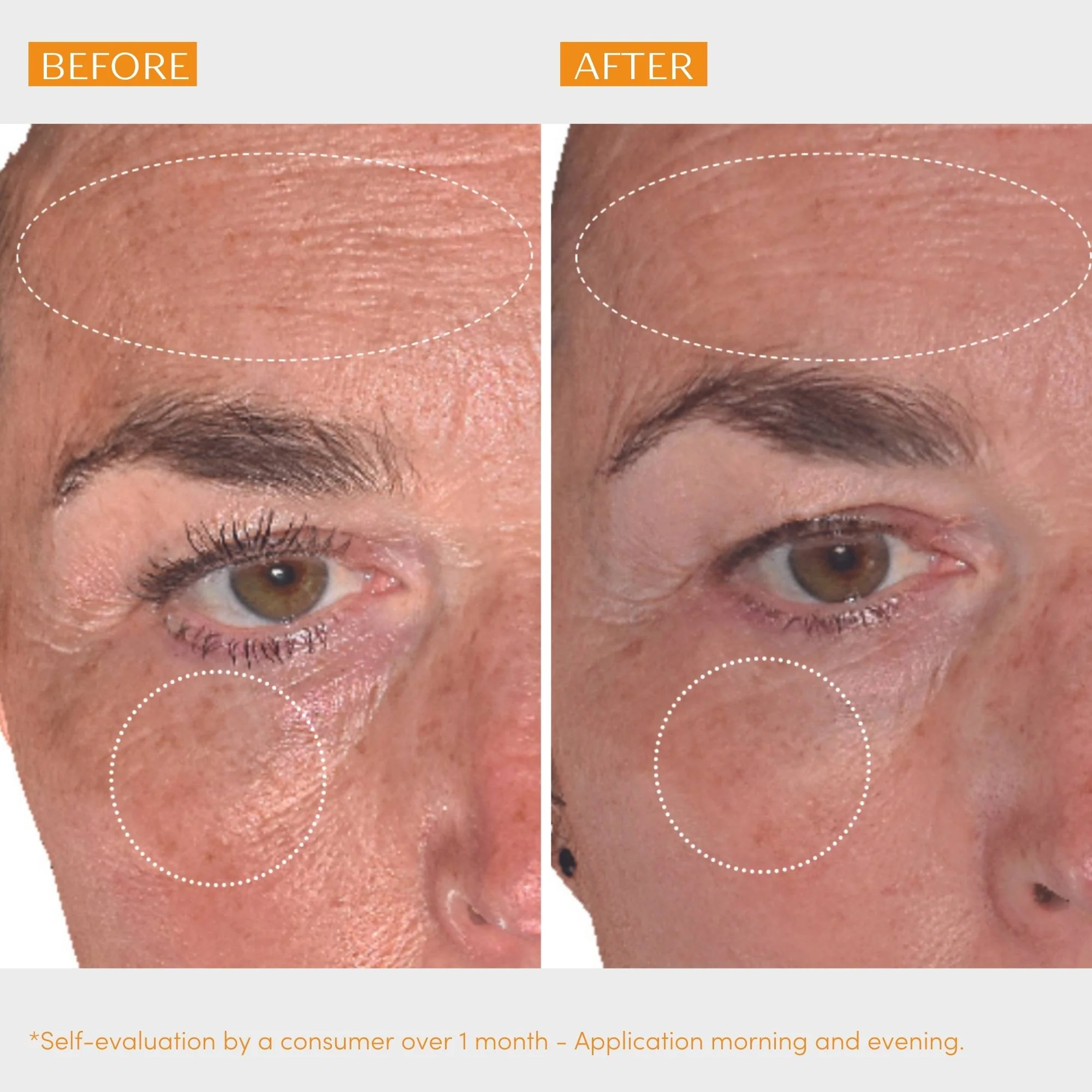 Serum C20 Vitamine C 5ml - Image 5
